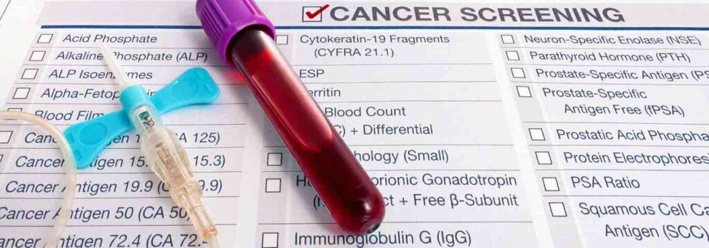 Can a blood test detect cancer? Debunk the myths. 