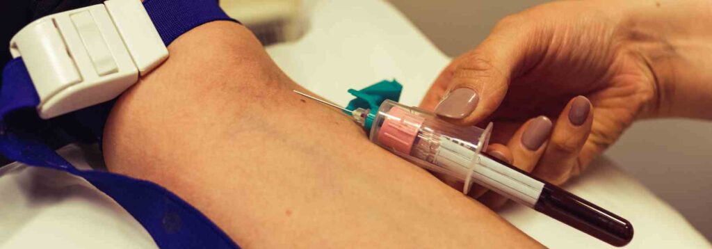 When to worry about an anaemia rash